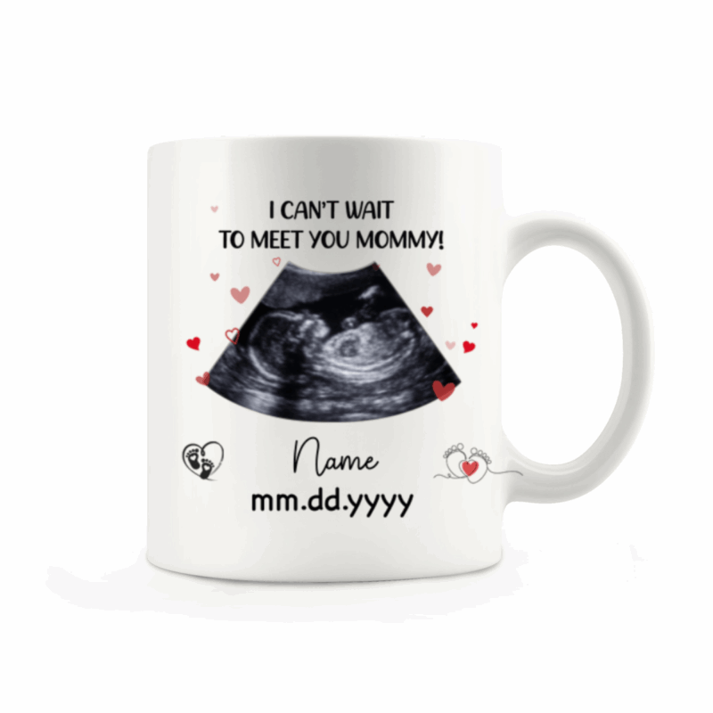 Personalized Ultrasound Photo Mug - I Can't Wait To Meet You Mommy Mug, First Mother’s Day Gift for Mom To Be, Pregnancy Reveal Gift