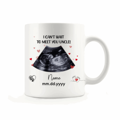 Personalized Ultrasound Photo Mug – I Can’t Wait To Meet You Uncle Mug, Pregnancy Reveal Gift, Uncle To Be Announcement Gift from Baby